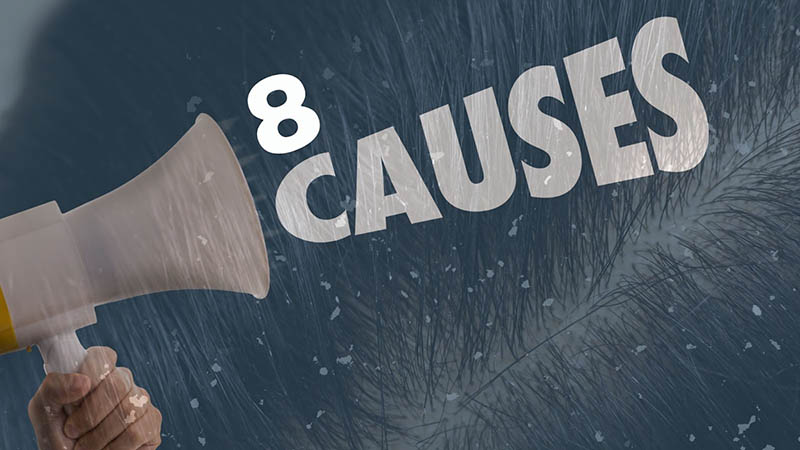 home remedies for dandruff and hairfall