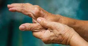 Ayurveda treatment for rheumatoid arthritis, Thumb arthritis