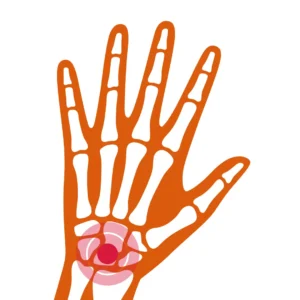 Integrated Medicine - Musculoskeletal Disorders Integrated Medicine for Musculoskeletal Disorders , arthritis