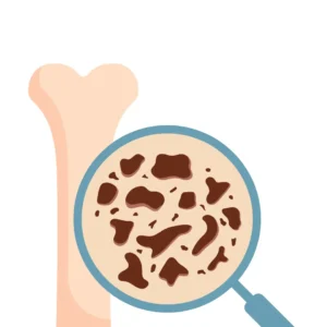 Integrated Medicine - Musculoskeletal Disorders Integrated Medicine for Musculoskeletal Disorders , bone