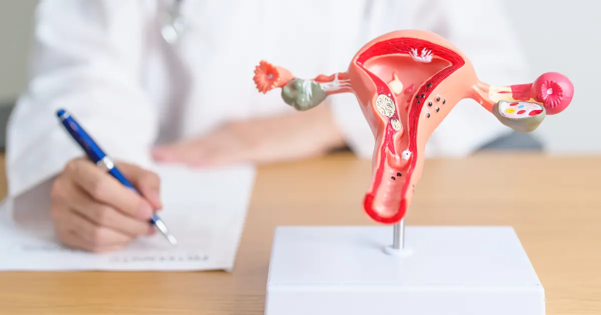 Ayurveda Treatment for Fibroids