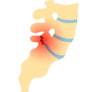 Integrated Medicine - Musculoskeletal Disorders Integrated Medicine for Musculoskeletal Disorders, spondylosis