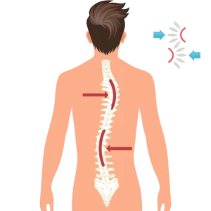 Integrated Medicine - Musculoskeletal Disorders Integrated Medicine for Scoliosis