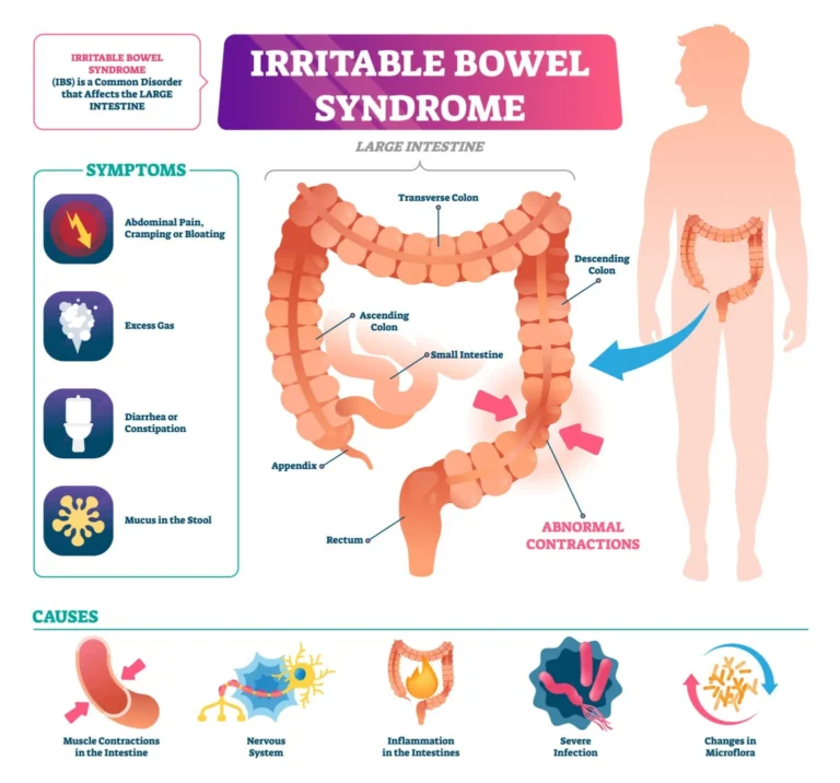 Symptoms of IBS can appear frequently, or, they may occur during flare-ups. Ayurveda Treatment For Irritable Bowel Syndrome,