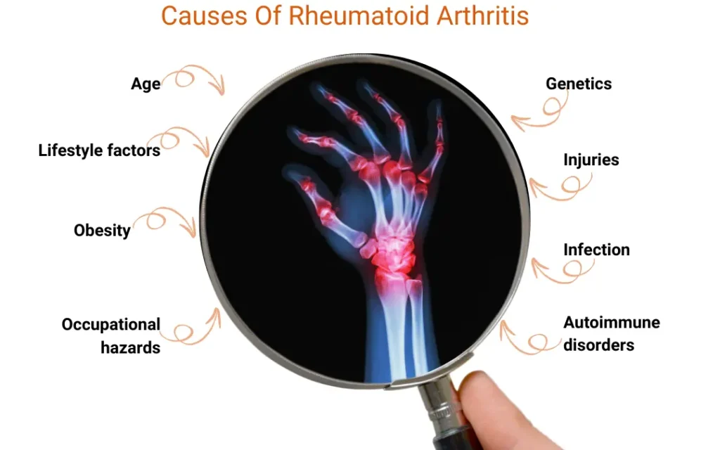 Ayurvedic treatment for Rheumatoid Arthritis Ayurveda treatment for Rheumatoid arthritis