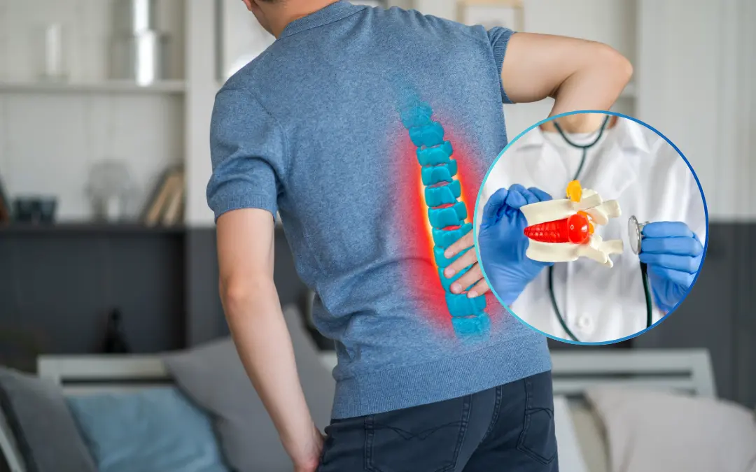 Ayurvedic Treatment for Disc Bulge