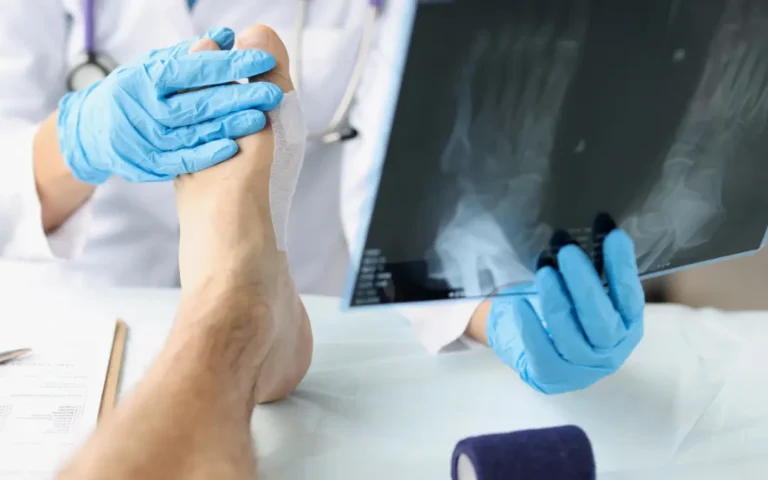 Can Rheumatoid Arthritis Cure Permanently in Ayurveda? Rheumatoid Arthritis Cure in Ayurveda