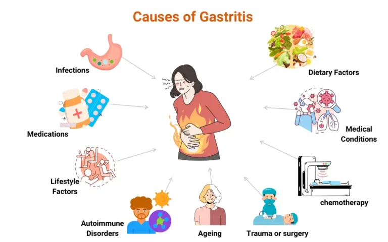 Ayurvedic Remedies for Gastritis: Your Natural Path to Relief Ayurvedic remedies for gastritis