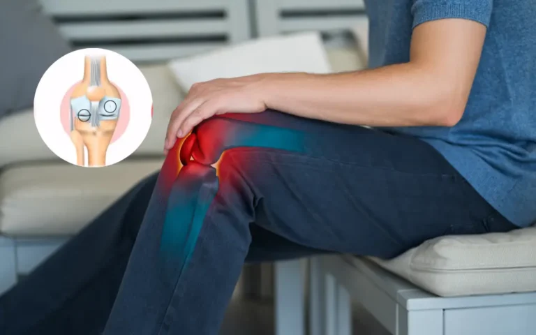 What are the 4 stages of Osteoarthritis? Can Ayurveda Provide Relief in Advanced Stage? stages of Osteoarthritis