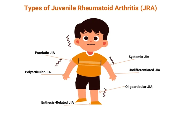 Ayurveda for Juvenile Rheumatoid Arthritis Care