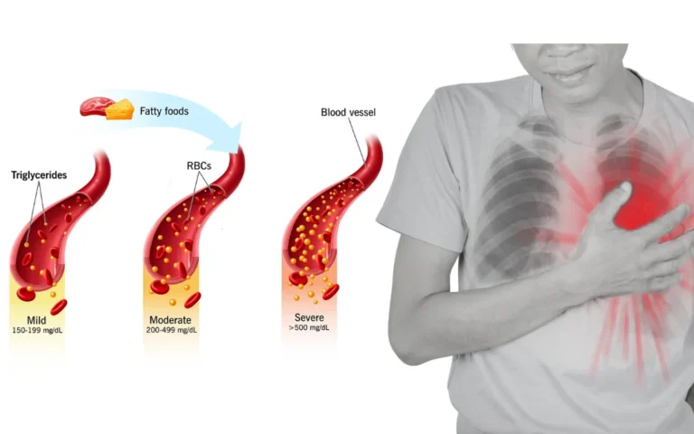 Revolutionize Your Heart Health: Dr. Kesavan Nambisan’s Proven Ayurvedic Approach to Balancing Triglycerides
