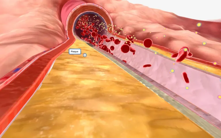 Ever wondered how Ayurveda’s Guduchi can transform your triglyceride levels? Discover the ancient secret to better heart health! Ever wondered how Ayurveda’s Guduchi can transform your triglyceride levels? Discover the ancient secret to better heart health!