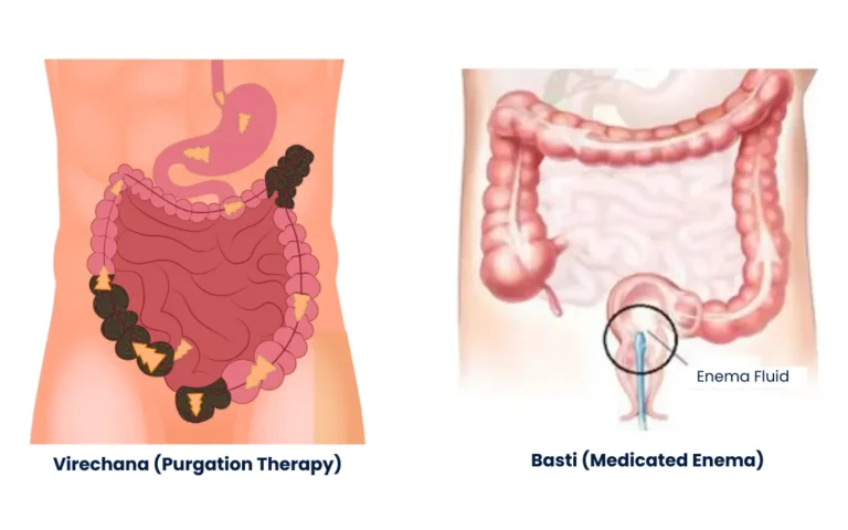 Revolutionize Your Heart Health: Dr. Kesavan Nambisan’s Proven Ayurvedic Approach to Balancing Triglycerides
