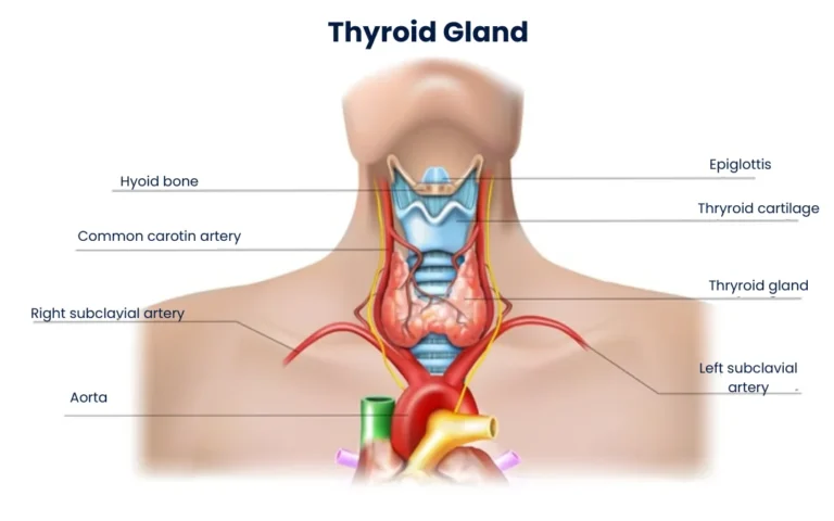 Hypothyroidism is a condition where the thyroid gland doesn't produce enough thyroid hormones, mainly thyroxine (T4) and triiodothyronine (T3)