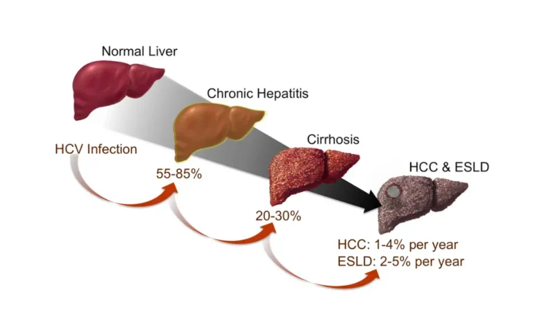 Ayurvedic treatment for Hepatitis Symptoms of Hepatitis