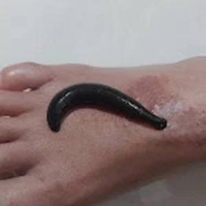 Partnered clinics Ayurveda clinic in bangalore