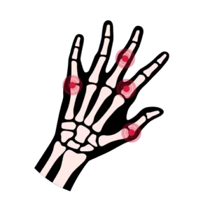 Integrated Medicine - Musculoskeletal Disorders Integrated Medicine - Musculoskeletal Disorders